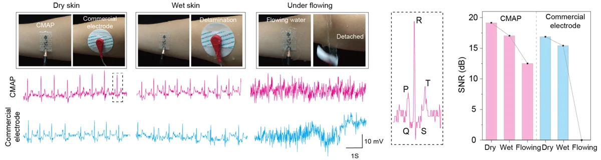 ECG recordings under dry, wet and sweating conditions.